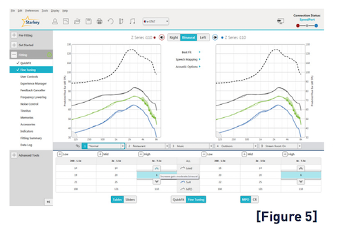 Inspire X software 2